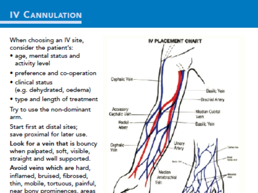 Iv Placement Chart